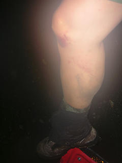 knee carnage