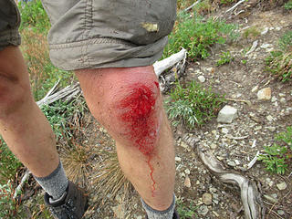 Dave smacked his knee on the brush bash